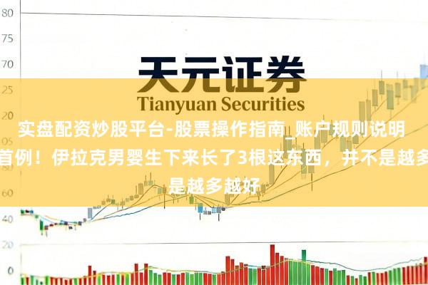 实盘配资炒股平台-股票操作指南_账户规则说明 大众首例！伊拉克男婴生下来长了3根这东西，并不是越多越好